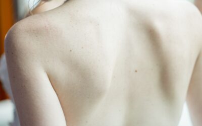 Last van een frozen shoulder? Volg deze oefeningen voor frozen shoulder